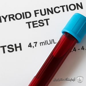 تفسیر جواب آزمایش تیروئید TSH