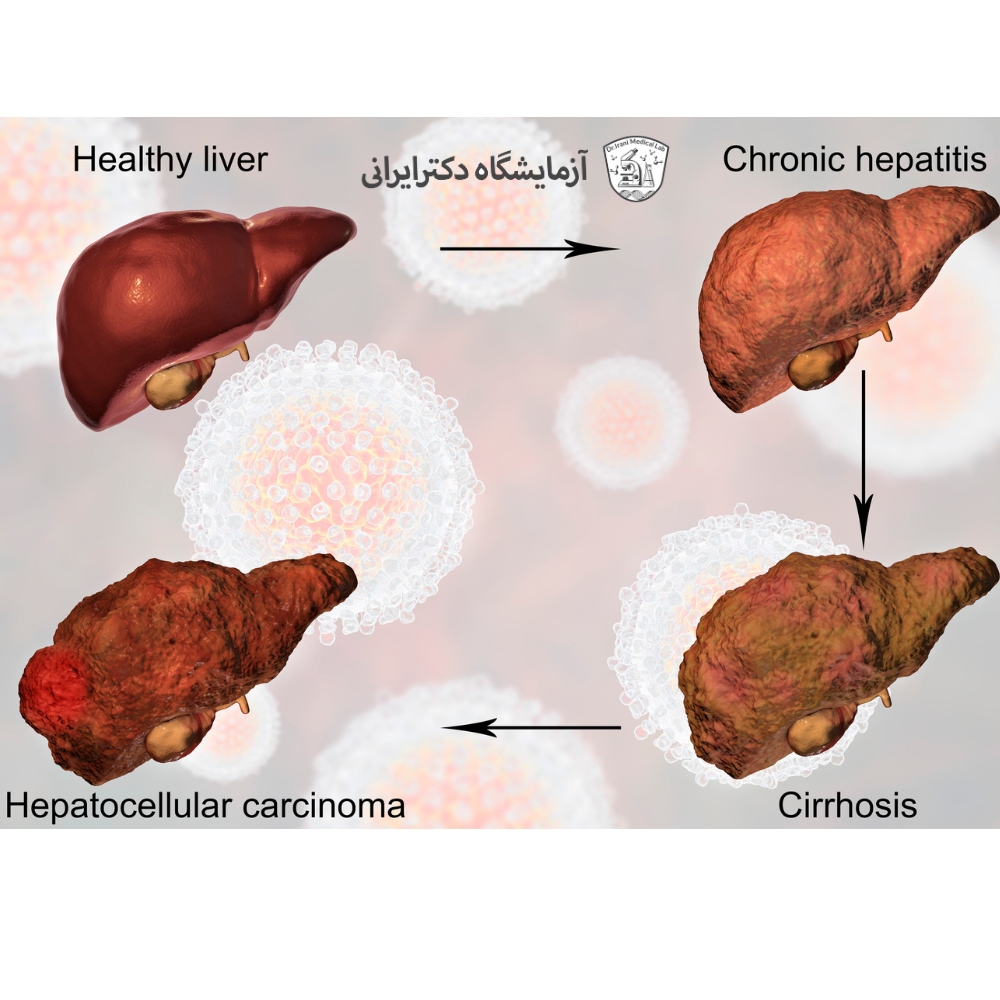بیماری های کبدی