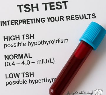 تفسیر جواب آزمایش تیروئید TSH