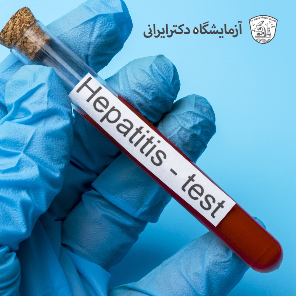 علائم هپاتیت